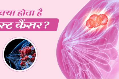 स्तन कैंसर क्या है? (What Is Breast Cancer?)