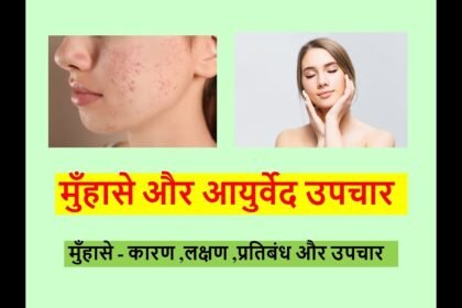 मुँहासे / फुंसी: उपचार, प्रक्रिया, लागत और दुष्प्रभाव | Acne/Pimples In India